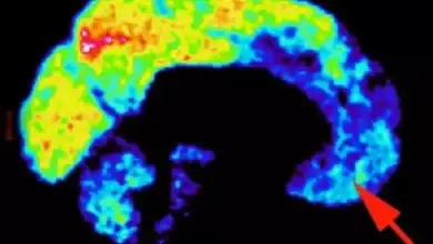 heres-what-a-psychopaths-brain-looks-like