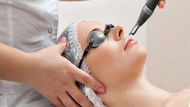 إزالة شعر الوجه بالليزر