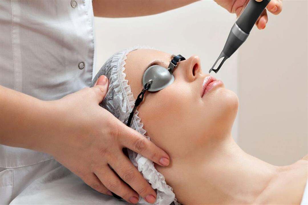 إزالة شعر الوجه بالليزر