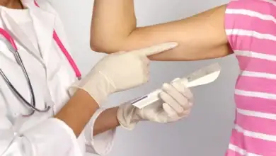 غرسة منع الحمل