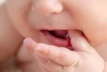 تسنين الأطفال