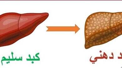 كبد دهني - سليم