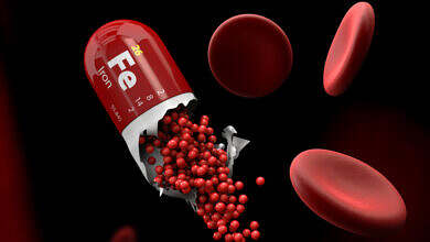 نقص الحديد في الجسم