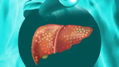 دهون-على-الكبد