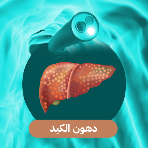 دهون-على-الكبد