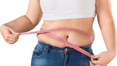 تراكم الدهون