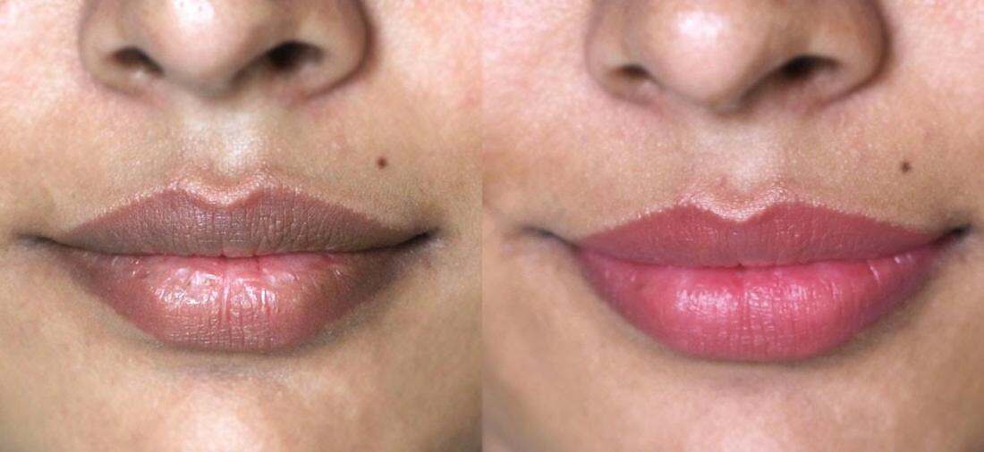 سواد الشفايف