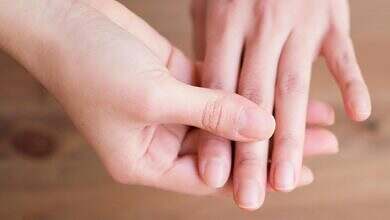 علامات في الأظافر