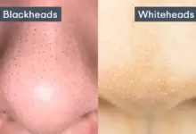 الرؤوس السوداء والبيضاء