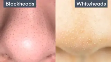 الرؤوس السوداء والبيضاء