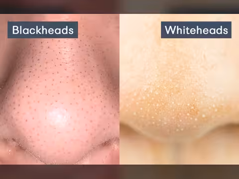 الرؤوس السوداء والبيضاء