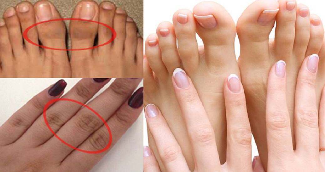 العناية بالقدمين