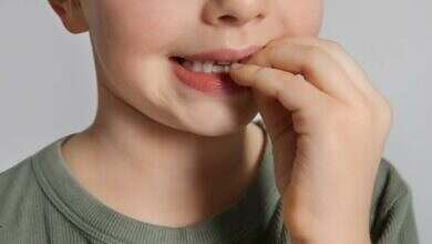 قضم الأظافر عند الاطفال