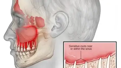 الأسنان والجيوب الأنفية