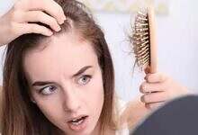 تساقط الشعر