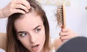 تساقط الشعر