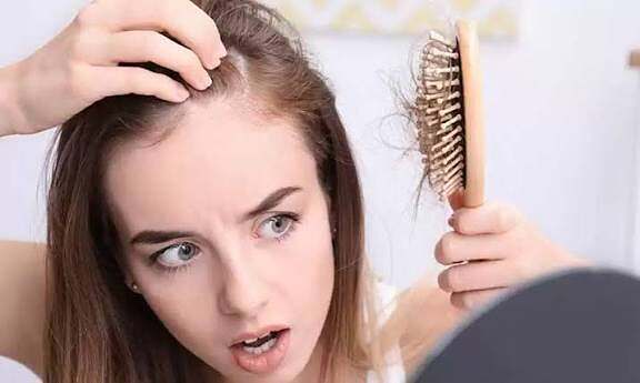 تساقط الشعر