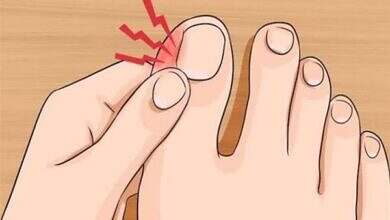 الظفر الغائر – علاج الظفر الغائر – أسباب الظفر الغائر