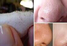 تنظيف المسام