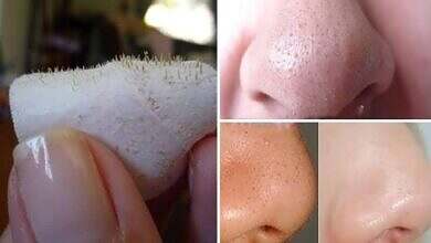 تنظيف المسام