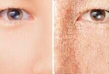 ترطيب البشرة في رمضان