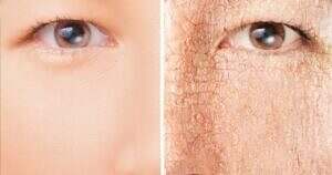 وداعاً للبشرة الباهتة.. كنز النصائح الذهبية لمحاربة جفاف الجلد في رمضان