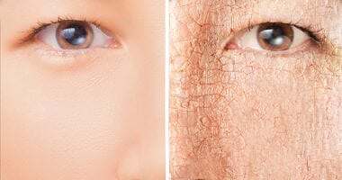 ترطيب البشرة في رمضان