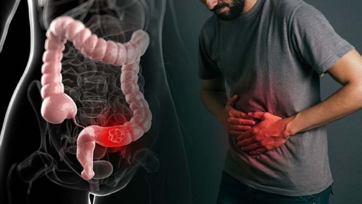 علاج الإمساك، رمضان 2026