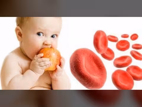 الانيميا عند الأطفال